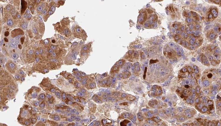 RIPK1 / RIP Antibody