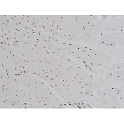 IGF1R / IGF1 Receptor Antibody (phospho-Tyr1346)