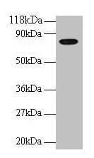 IHC-plus™ Polyclonal Rabbit anti-Human TF / Transferrin Antibody (aa20-698, IHC, WB)