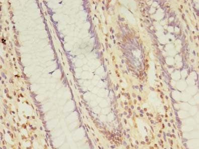 Polyclonal Rabbit anti-Human NARS2 Antibody (IHC)