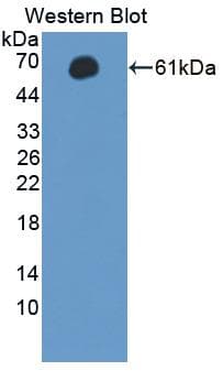 MAST205 / MAST2 Antibody (aa512-785)