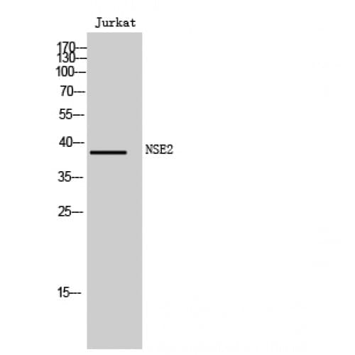 Polyclonal Rabbit anti-Human FAM84B Antibody (30-110 aa, N-terminal, IHC, WB)
