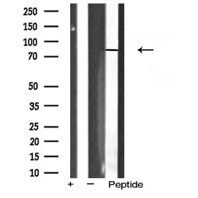 Polyclonal Rabbit anti-Human FSH Receptor / FSHR Antibody (IHC, IF, WB)