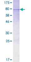 Human TBC1D19 Protein (Recombinant GST)