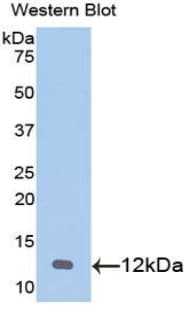 CXCL1 / GRO Alpha Antibody (aa25-96)