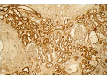 IHC-plus™ Collagen VI Antibody