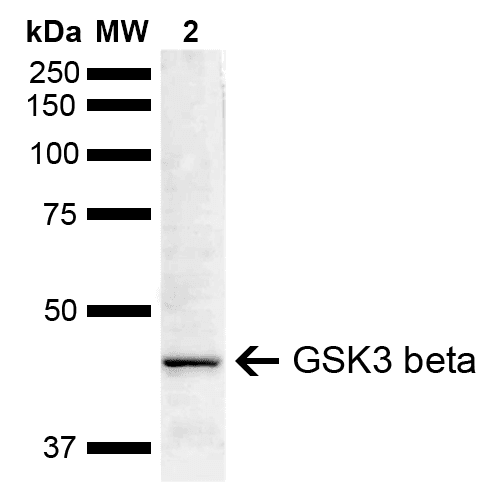 GSK3B / GSK3 Beta Antibody (Biotin)