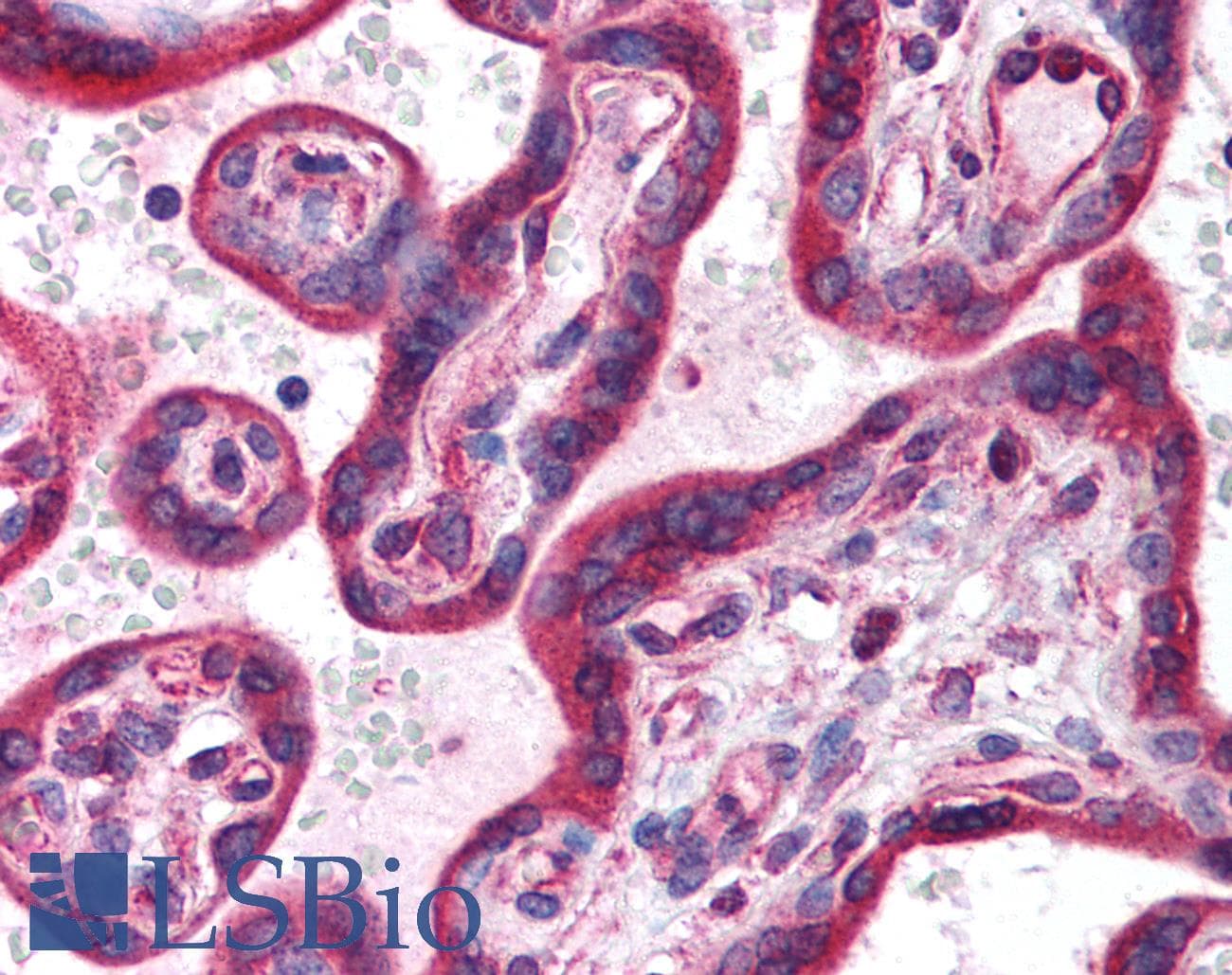 IHC-plus™ HIF3A / HIF3-Alpha Antibody