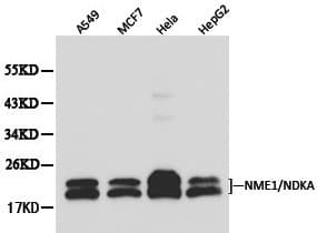 Polyclonal Rabbit anti-Human NME1 / NM23 Antibody (IHC, WB)
