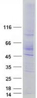 Human SLC18A2 / VMAT2 Protein (Recombinant Myc-DDK (Flag))