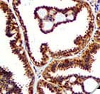 PTEN Antibody (clone RBT-PTEN)