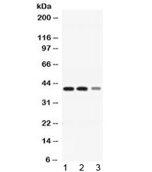 Polyclonal Rabbit anti-Human ADH4 Antibody (WB)