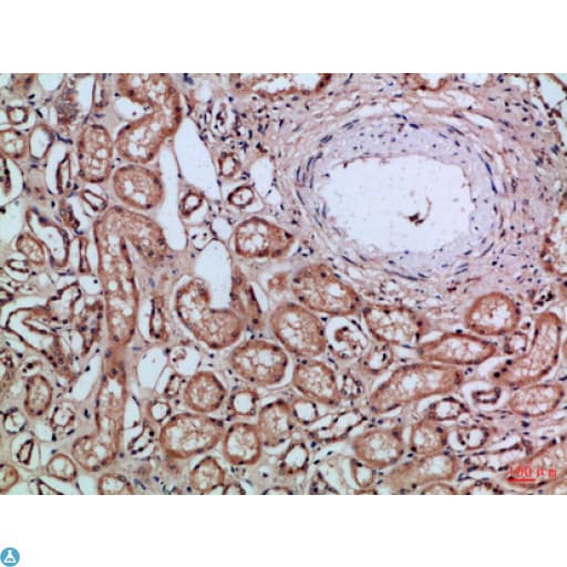 CD66a / CEACAM1 Antibody