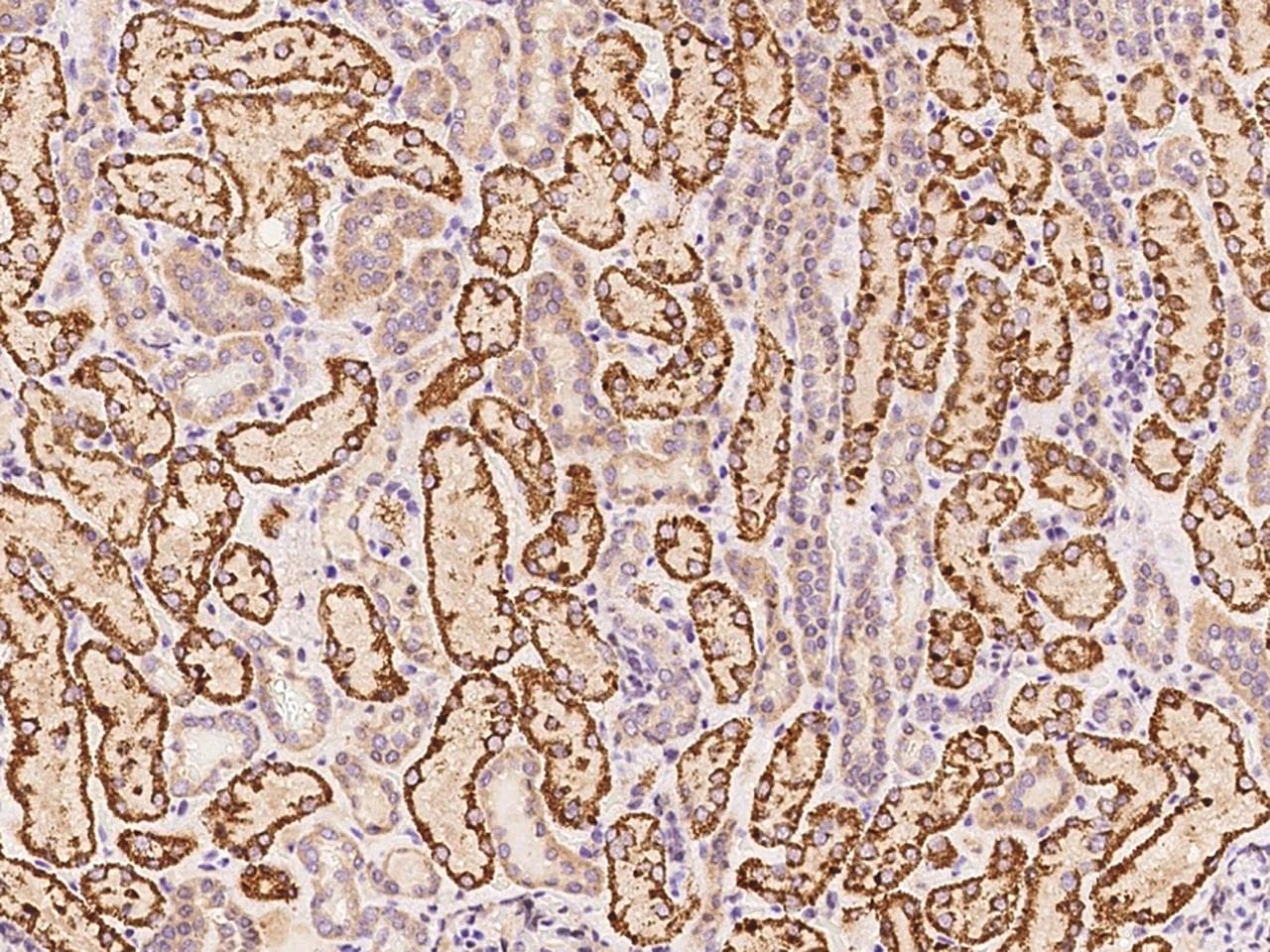 TRAIL-R4 / DCR2 Antibody (Preservative Free)