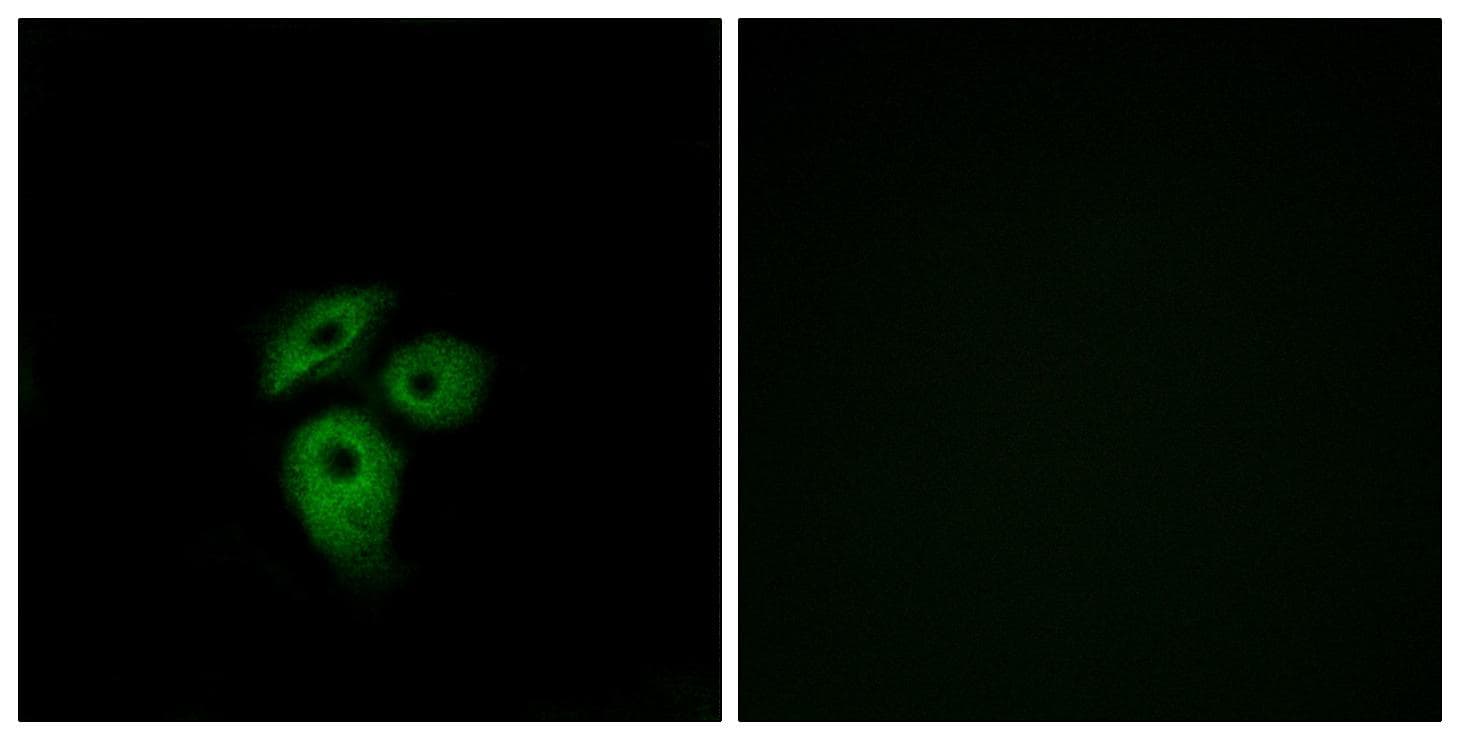 ACKR1 / DARC Antibody