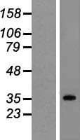 SUCLG1 / GALPHA Protein (Over-Expression Lysate Myc-DDK (Flag))