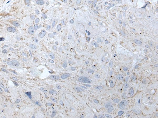 RASA1 Antibody