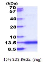 Human CAMK2N2 / CAMKIIN Protein (Recombinant His)