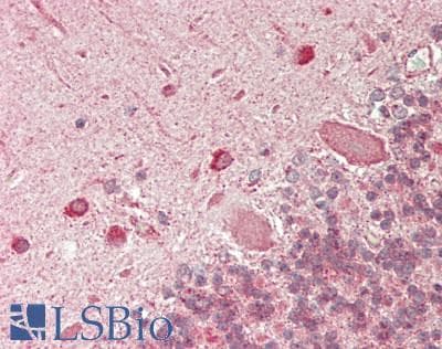IHC-plus™ Polyclonal Rabbit anti-Human UBE3C Antibody (aa725-775, IHC)