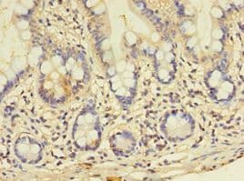 GALNT14 Antibody (aa1-552)