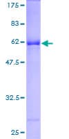 Human Rhodanese / TST Protein (Recombinant GST)