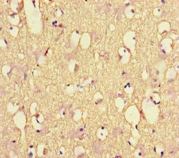 NF-L / NEFL Antibody (aa128-271)