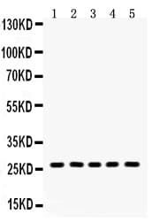 HSD17B10 / HADH2 Antibody (aa48-261)