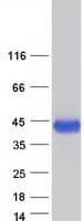 Human CTSB / Cathepsin B Protein (Recombinant Myc-DDK (Flag))