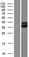 MYD88 Protein (Over-Expression Lysate Myc-DDK (Flag))