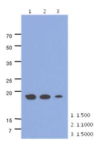 ADI1 / ARD Antibody (clone AT27E8)