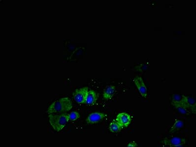 SSTR4 Antibody (aa314-388)