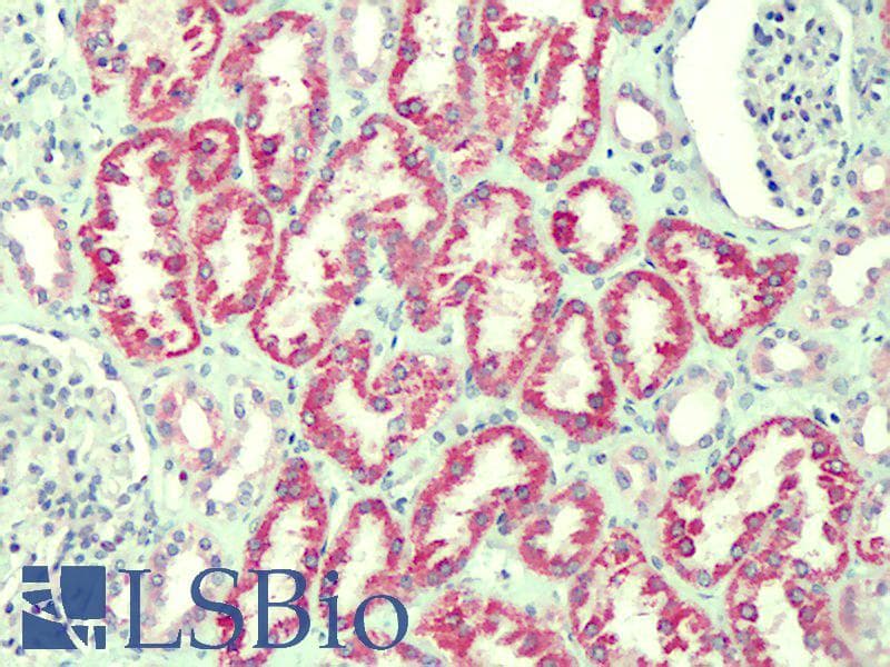 IHC-plus™ ANTXR2 / CMG2 Antibody (aa121-133)