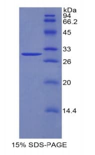 Mouse F5 / Factor Va Protein (Recombinant His)