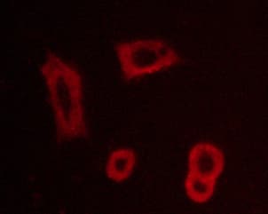 Polyclonal Rabbit anti-Human EGFR Antibody (phospho-Tyr1016, IHC, IF, WB)