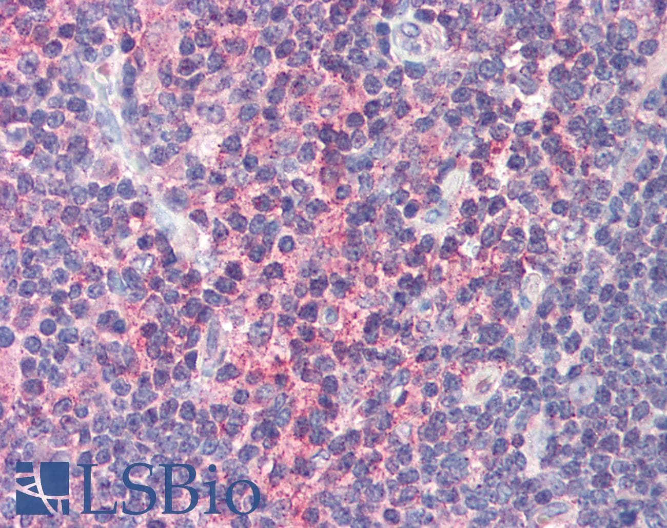IHC-plus™ Polyclonal Rabbit anti-Human IRF7 Antibody (IHC, IF, WB)