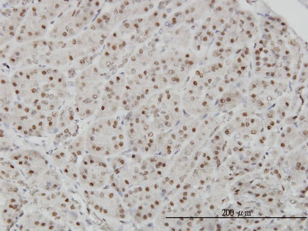 AKAP8 / AKAP95 Antibody (clone 3D4)