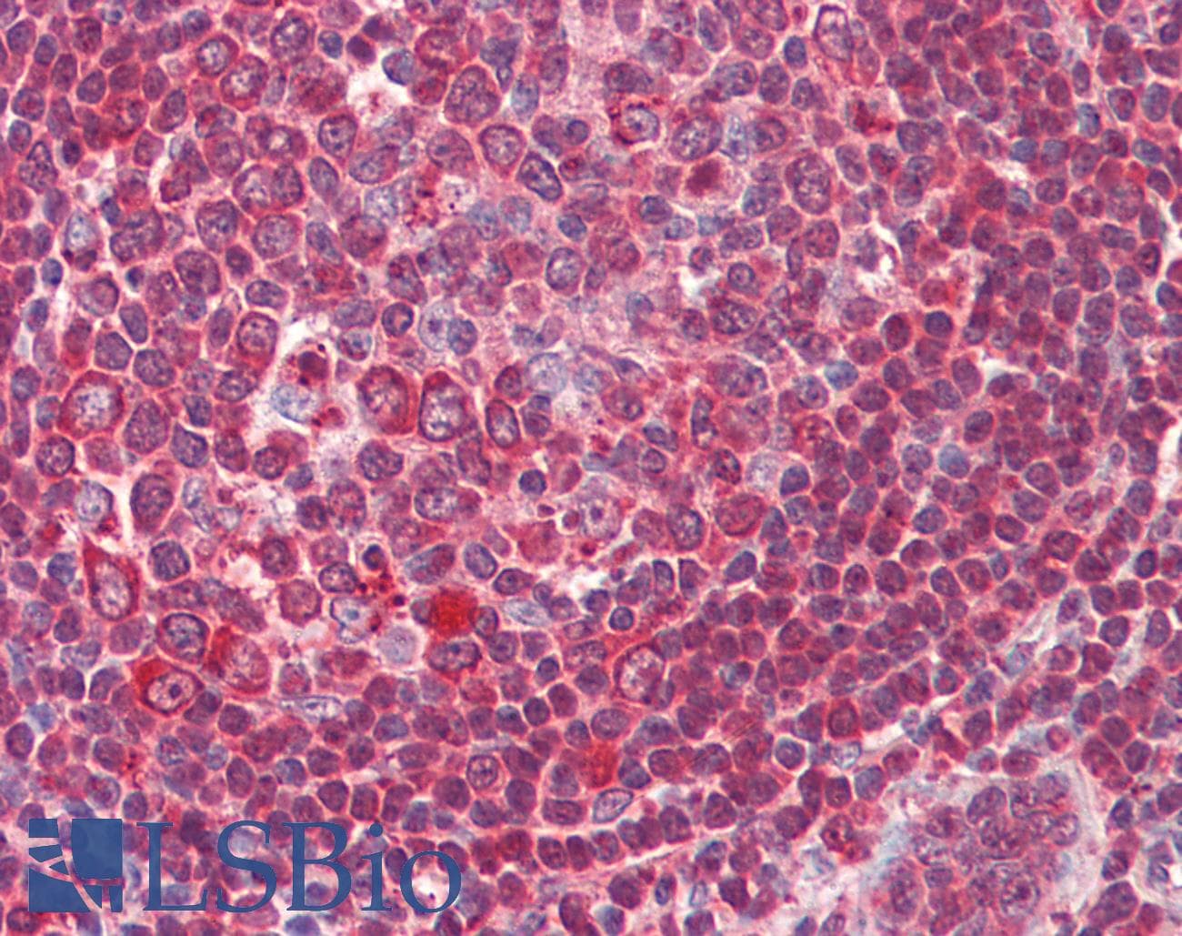 IHC-plus™ ERCC1 Antibody (aa172-184)