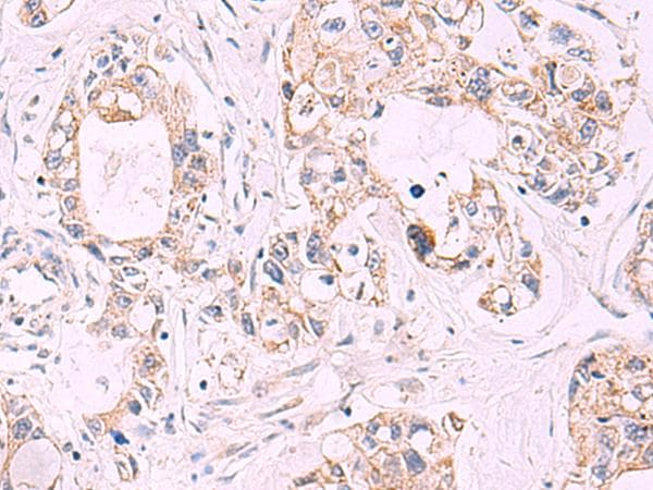 TNF Alpha Antibody