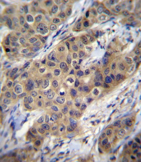 TGFB1 / TGF Beta 1 Antibody (aa22-50)