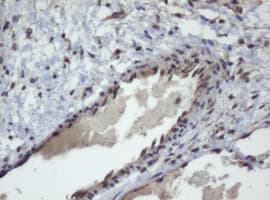 ZSCAN4 Antibody (clone OTI1A6)