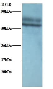 YARS / Tyrosyl-tRNA Synthetase Antibody (Biotin)