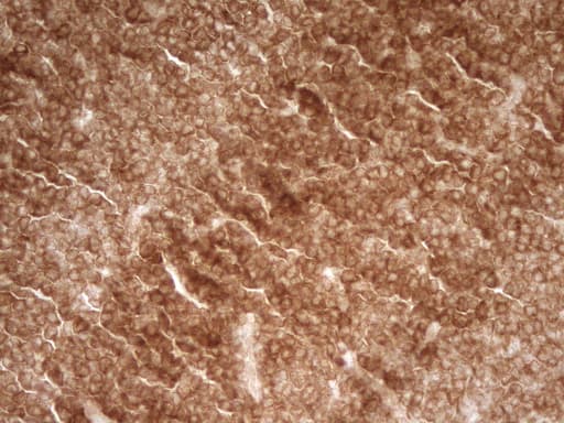 Monoclonal Mouse anti-Human PRMT5 Antibody (clone OTI4G7, aa238-499, IHC)