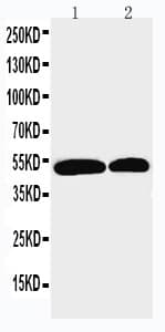Polyclonal Rabbit anti-Human NOXA1 Antibody (aa176-195, WB)