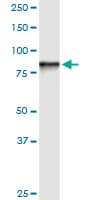 IHC-plus™ Monoclonal Mouse anti-Human GOK / STIM1 Antibody (clone 5A2, IHC, IF, WB)