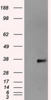 NEK6 Antibody (clone OTI2H7)