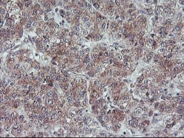 FMR1 / FMRP Antibody (clone OTI2C3)