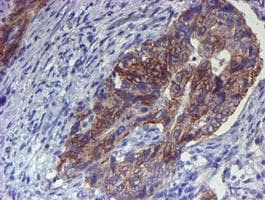 Monoclonal Mouse anti-Human ERBB2 / HER2 Antibody (clone OTI12G4, Carrier-free, aa676-1255, IHC, IF, WB)
