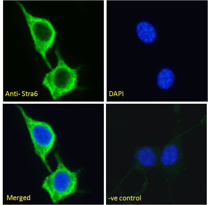 STRA6 Antibody (aa187-199)