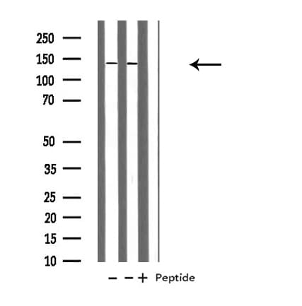 Polyclonal Rabbit anti-Human POLR1B Antibody (IHC, IF, WB)