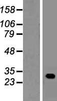GUCD1 Protein (Over-Expression Lysate Myc-DDK (Flag))